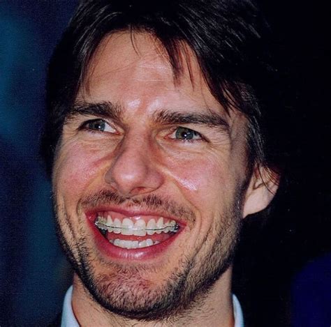 tom cruise teeth before|tom cruise middle front tooth.